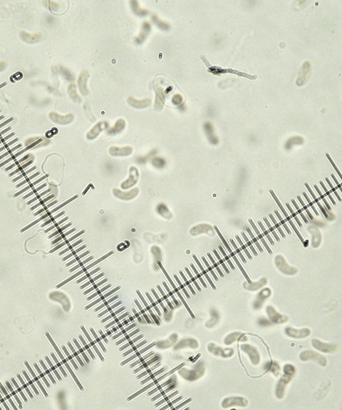 Gloeoporus taxicola? (Gloeoporus taxicola)